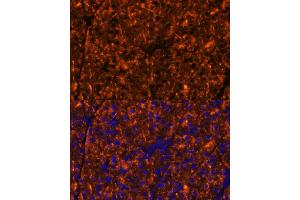 Immunofluorescence analysis of mouse pancreas using SERPINI2 Polyclonal Antibody (ABIN6131321, ABIN6147617, ABIN6147618 and ABIN6215429) at dilution of 1:100 (40x lens). (SERPINI2 抗体  (AA 56-405))