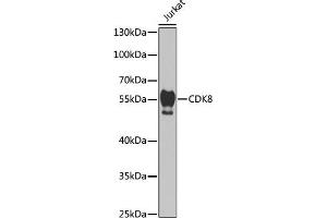 Western blot analysis of extracts of Jurkat cells, using CDK8 antibody (ABIN6129240, ABIN6138329, ABIN6138330 and ABIN7101776) at 1:1000 dilution. (CDK8 抗体  (AA 365-464))