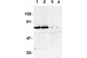 Western blot analysis of DR6 in K562 (1,3) and Raji (2,4) whole cell lysate in the absence (1,2) or presence (3,4) of blocking peptide with AP30301PU-N DR6 antibody at 1/500 dilution. (TNFRSF21 抗体  (AA 42-56))