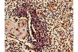 Immunohistochemistry of paraffin-embedded human spleen tissue using ABIN7142496 at dilution of 1:100 (RPS15 抗体  (AA 63-137))