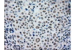 Image no. 2 for anti-TYRO3 Protein Tyrosine Kinase (TYRO3) antibody (ABIN1501607) (TYRO3 抗体)