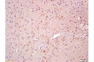 Formalin-fixed and paraffin embedded rat brain labeled with Anti-CNTF Polyclonal Antibody, Unconjugated (ABIN674229) at 1:200 followed by conjugation to the secondary antibody and DAB staining (CNTF 抗体  (AA 21-150))