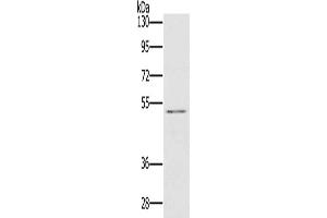 Gel: 8 % SDS-PAGE, Lysate: 40 μg, Lane: HT29 cells, Primary antibody: ABIN7129785(HTR3C Antibody) at dilution 1/500, Secondary antibody: Goat anti rabbit IgG at 1/8000 dilution, Exposure time: 20 seconds (HTR3C 抗体)