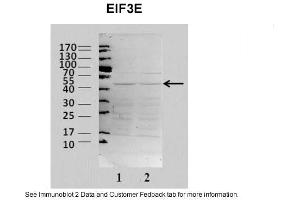 Sample Type: 2. (EIF3E 抗体  (N-Term))