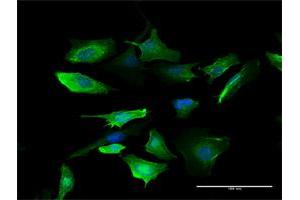 Immunofluorescence (IF) image for anti-S100 Calcium Binding Protein A10 (S100A10) (AA 1-97) antibody (ABIN948436)