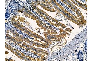 ABIN6265800 and ABIN6266909 at 1/100 staining rat colorectal tissue by IHC-P. (TUBGCP5 抗体  (Internal Region))