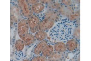 Immunohistochemistry (IHC) image for anti-Signal Transducing Adaptor Molecule (SH3 Domain and ITAM Motif) 2 (STAM2) (AA 1-377) antibody (ABIN5014322)