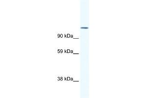 WB Suggested Anti-NFATC2 Antibody Titration:  1. (NFAT1 抗体  (N-Term))