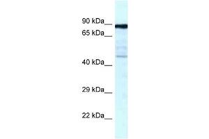 Western Blot showing CKAP2 antibody used at a concentration of 1 ug/ml against Fetal Lung Lysate (CKAP2 抗体  (C-Term))