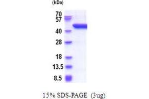SDS-PAGE (SDS) image for serpin Peptidase Inhibitor, Clade B (Ovalbumin), Member 8 (SERPINB8) (AA 1-374) protein (His tag) (ABIN5854005) (SERPINB8 Protein (AA 1-374) (His tag))
