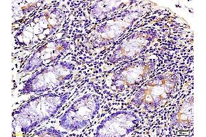 Immunohistochemistry (Paraffin-embedded Sections) (IHC (p)) image for anti-WNK Lysine Deficient Protein Kinase 3 (WNK3) (AA 451-550) antibody (ABIN675713)