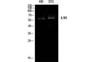 Western Blot (WB) analysis of KB, NIH-3T3 cells using IL-9R Polyclonal Antibody. (IL9 Receptor 抗体  (Internal Region))