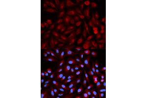 Immunofluorescence analysis of HeLa cells using PSME3 antibody. (PSME3 抗体)