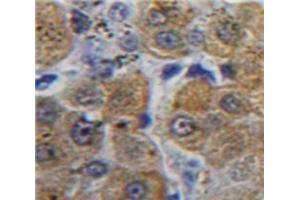 Used in DAB staining on fromalin fixed paraffin-embedded Liver tissue (aHSP 抗体  (AA 1-102))