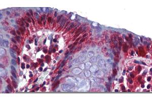 human Colon (RBM47 抗体  (Middle Region))