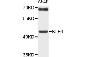 Western blot analysis of extracts of A-549 cells, using KLF6 antibody (ABIN4904165) at 1:1000 dilution. (KLF6 抗体)