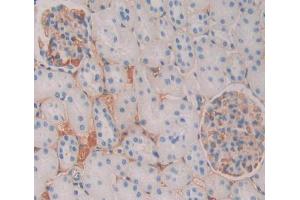 IHC-P analysis of kidney tissue, with DAB staining. (CAMLG 抗体  (AA 1-188))