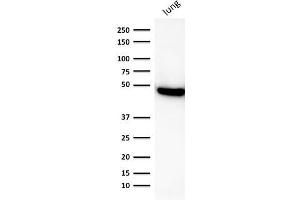 Western Blot Analysis of human lung lysate using CK19 Mouse Recombinant Monoclonal Antibody (rKRT19/800). (Recombinant Cytokeratin 19 抗体)
