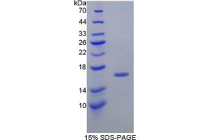 SDS-PAGE analysis of Guinea Pig Transthyretin Protein. (TTR 蛋白)