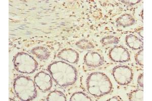Immunohistochemistry of paraffin-embedded human colon tissue using ABIN7143116 at dilution of 1:100 (ACTRT1 抗体  (AA 201-376))