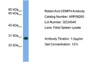WB Suggested Anti-CENPH  Antibody Titration: 0. (CENPH 抗体  (N-Term))