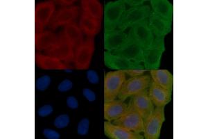 ABIN6266202 and ABIN6277355 staining Hela cells(30 min of UV treatment) by IF/ICC. (Dopamine Receptor d1 抗体  (N-Term))