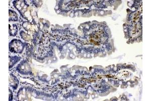 IHC testing of FFPE rat small intestine tissue with Calpain 2 antibody at 1ug/ml. (Calpain 2 抗体)