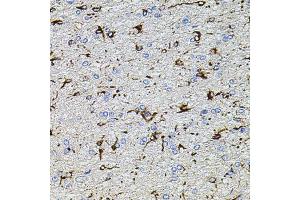 Immunohistochemistry of paraffin-embedded rat brain using TRPA1 antibody (ABIN5996346) at dilution of 1/100 (40x lens). (TRPA1 抗体)