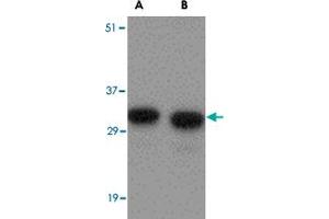 Western blot analysis of NIPSNAP1 in human brain tissue lysate with NIPSNAP1 polyclonal antibody  at (A) 0. (NIPSNAP1 抗体  (Internal Region))