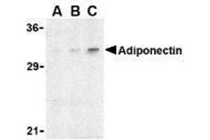Western blot analysis of adiponectin in rat brain cell lysate with AP30023PU-N adiponectin antibody at (A) 1, (B) 2, and (C) 4 μg/ml. (ADIPOQ 抗体  (N-Term))
