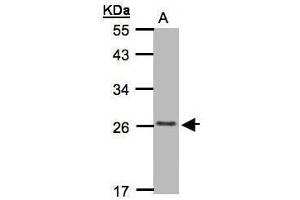 WB Image Sample(30 μg of whole cell lysate) A:MOLT4 whole cell lysate , 12% SDS PAGE antibody diluted at 1:1000 (CMTM5 抗体  (C-Term))