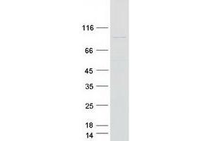 Western Blotting (WB) image for Exocyst Complex Component 6 (EXOC6) (Transcript Variant 1) protein (Myc-DYKDDDDK Tag) (ABIN2720610)