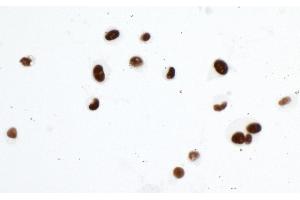 Immunocytochemistry (ICC) image for anti-Tripartite Motif Containing 28 (TRIM28) (Ser824) antibody (ABIN7454012) (Recombinant KAP1 抗体  (Ser824))