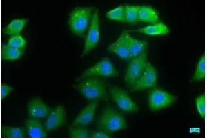 Immunofluorescence staining of Hela cells with ABIN7165849 at 1:66, counter-stained with DAPI. (NDRG1 抗体  (AA 136-394))