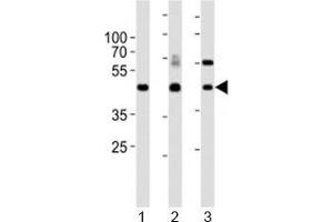 Western blot analysis of lysate from 1) mouse kidney, 2) mouse thymus and 3) rat lung tissue lysate using Dlk1 antibody. (DLK1 抗体  (C-Term))