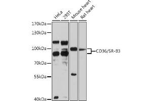 Western blot analysis of extracts of various cell lines, using CD36/SR-B3 antibody (ABIN3015504, ABIN3015505, ABIN1679086, ABIN5663919 and ABIN6218561) at 1:3000 dilution. (CD36 抗体  (AA 301-400))