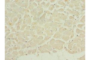 Immunohistochemistry of paraffin-embedded human heart tissue using ABIN7150764 at dilution of 1:100 (DUSP22 抗体  (AA 1-184))