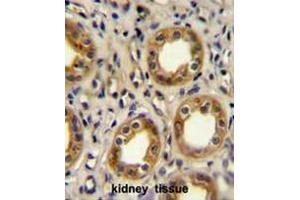 CXCR3 Antibody (Center) immunohistochemistry analysis in formalin fixed and paraffin embedded human kidney tissue followed by peroxidase conjugation of the secondary antibody and DAB staining. (CXCR3 抗体  (Middle Region))