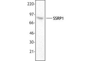Image no. 1 for anti-Structure Specific Recognition Protein 1 (SSRP1) antibody (ABIN205478) (SSRP1 抗体)