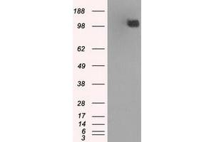 Image no. 11 for anti-Budding Uninhibited By Benzimidazoles 1 Homolog beta (Yeast) (BUB1B) antibody (ABIN1496996) (BUB1B 抗体)
