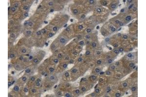 Immunohistochemistry (IHC) image for anti-Receptor tyrosine-protein kinase erbB-2 (ErbB2/Her2) (AA 23-372) antibody (ABIN7444448)