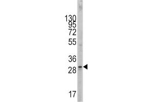 Western Blotting (WB) image for anti-KIT Ligand (KITLG) antibody (ABIN2998288) (KIT Ligand 抗体)