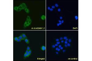 ABIN185301 Immunofluorescence analysis of paraformaldehyde fixed A431 cells, permeabilized with 0. (ADAM12 抗体  (N-Term))