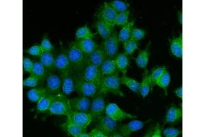 IF analysis of RAB13 using anti-RAB13 antibody (ABIN7600599).