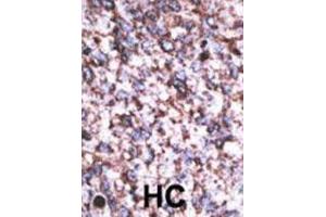 Immunohistochemistry (IHC) image for anti-beta-Site APP-Cleaving Enzyme 2 C (BACE2 C) antibody (ABIN2995239) (BACE2C 抗体)