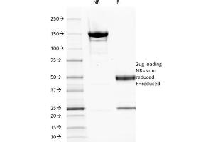 SDS-PAGE Analysis Purified EGFR Mouse Monoclonal Antibody (GFR1195). (EGFR 抗体  (Extracellular Domain))