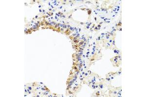 Immunohistochemistry of paraffin-embedded rat lung using CXCL8 antibody (ABIN6290535) at dilution of 1:100 (40x lens). (IL-8 抗体)