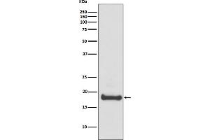 Western blot analysis of ARF6 expression in 293T cell lysate. (Recombinant ARF6 抗体)