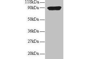 Western blot All lanes: CXCL5 antibody at 2 μg/mL + 293T whole cell lysate Secondary Goat polyclonal to rabbit IgG at 1/15000 dilution Predicted band size: 12 kDa Observed band size: 90 kDa (CXCL5 抗体  (AA 37-110))