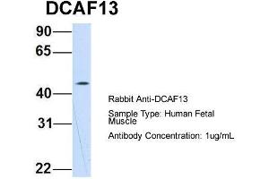 Host: Rabbit  Target Name: DCAF13  Sample Tissue: Human Fetal Muscle  Antibody Dilution: 1. (DCAF13 抗体  (N-Term))